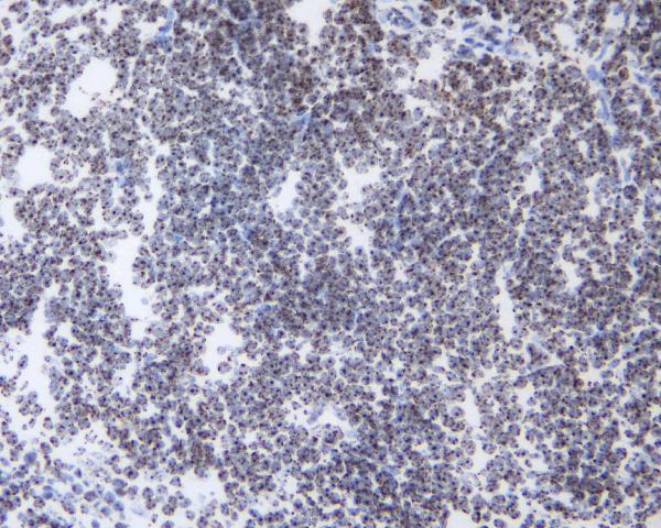 a01142 hp1_gamma primary antibodies ihc f testing 11