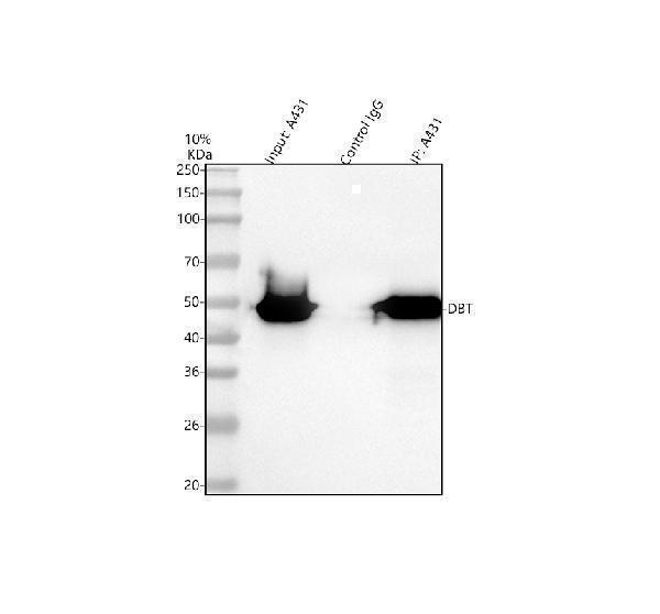 Immunoprecipitating DBT in A431 whole cell lysate