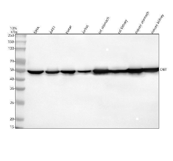 Western blot analysis of DBT using anti-DBT antibody (A01145-2)