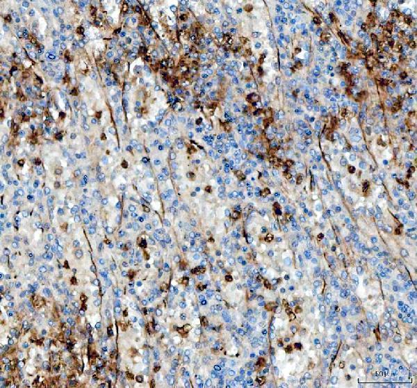 a01147 angptl4 primary antibodies ihc testing 3