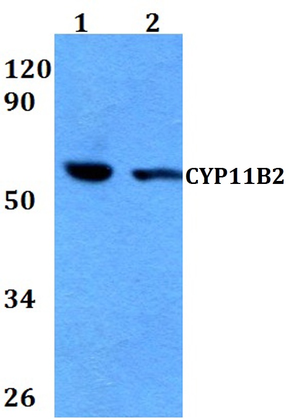 Western blot (WB) analysis of CYP11B2 polyclonal antibody at 1:500 dilution
Lane1:HEK293T whole cell lysate
Lane2:Raw264
