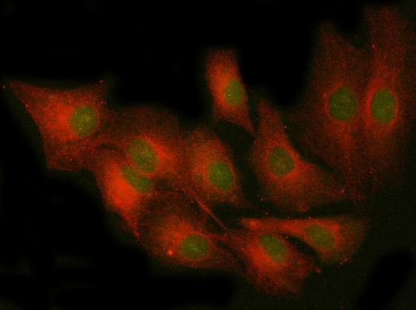  IF analysis of PRKCE4 using anti-PRKCE4 antibody (A01151-1) and anti-Tubulin Alpha antibody (M03989-3)