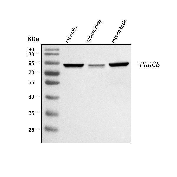  Western blot analysis of PRKCE using anti-PRKCE antibody (A01151-1)