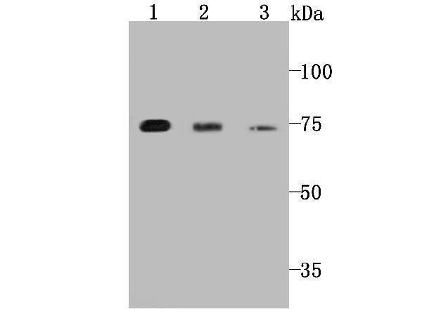 a01151 prkce primary antiboties wb testing 1
