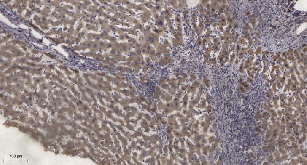 a01151s729 1 prkce primary antibodies ihc testing 3