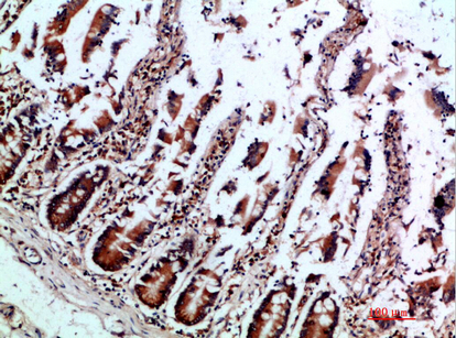 Immunohistochemistry validation of IL12B using Anti-IL-12B p40 Antibody (A01152)