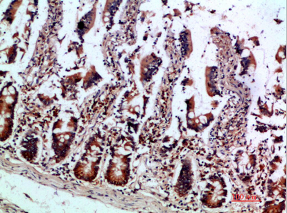 Immunohistochemistry validation of IL12B using Anti-IL-12B p40 Antibody (A01152)