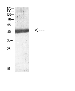 Western blotting validation for Anti-IL-12B p40 Antibody A01152
Western blot analysis of mouse-kidney lysate
