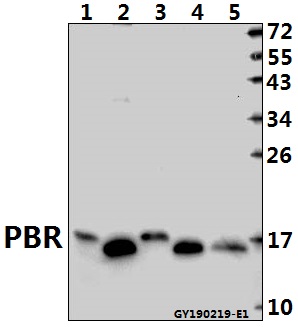 Western blot (WB) analysis of PBR pAb at 1:2000 dilution
Lane1:PMVEC whole cell lysate(40ug)
Lane2:HepG2 whole cell lysate(40ug)
Lane3:3T3-L1 whole cell lysate(40ug)
Lane4:A2780 whole cell lysate(40ug)
Lane5:A549 whole cell lysate(40ug)