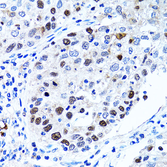 a01156 uhrf1 primary antiboties ihc testing 2