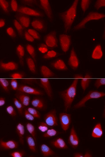 a01156 uhrf1 primary antiboties ihc testing 3