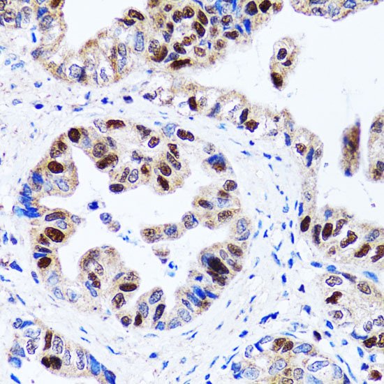 a01156 uhrf1 primary antiboties ihc testing 4