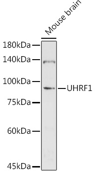 a01156 uhrf1 primary antiboties wb testing 1