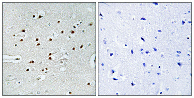 a01157 mkl1 primary antibodyes ihc testing 2
