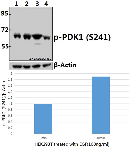Western blot (WB) analysis of p-PDK1 (S241) pAb at 1:1000 dilution
Lane1:HEK293T whole cell lysate(40ug)
Lane2:HEK293T treated with EGF(100ng/ml,30 minutes) whole cell lysate(40ug)
Lane3:C6 whole cell lysate(40ug)
Lane4:CT26 whole cell lysate(40ug)