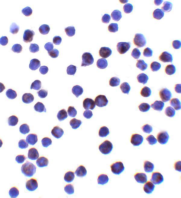 a01160 2 il 11 primary antibodies icc testing 2