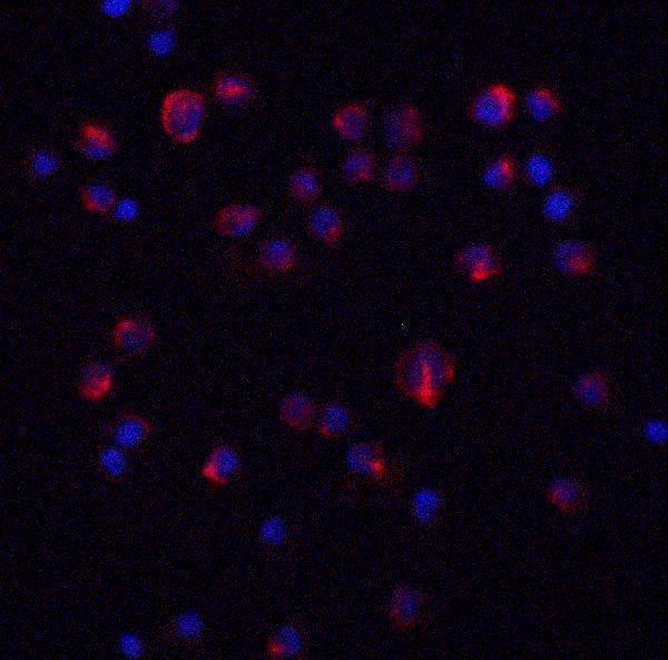 a01160 2 il 11 primary antibodies if testing 3
