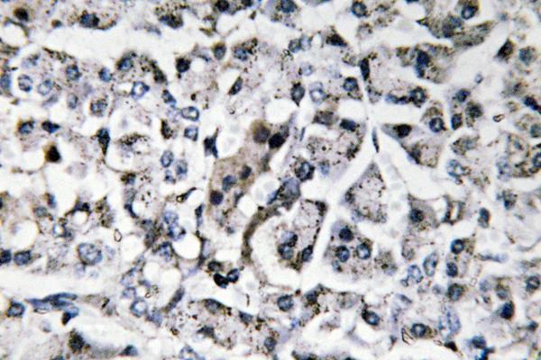 a01160 3 il11 primary antibodies ihc testing 1
