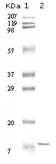 Western Blot analysis using IL-11 Monoclonal Antibody against truncated IL-11 recombinant protein