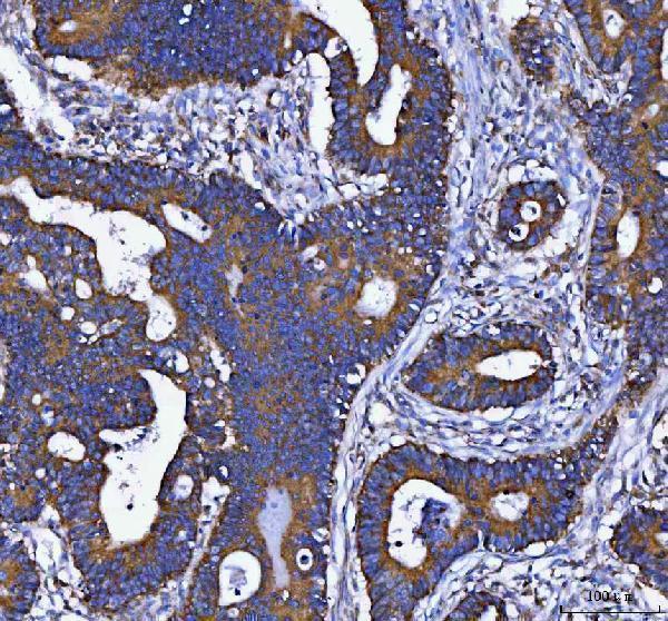  IHC analysis of DAPK1 using anti-DAPK1 antibody (A01161-1)