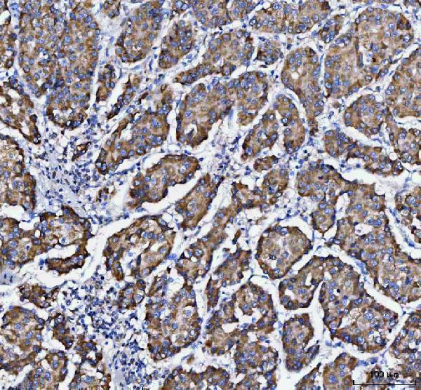  IHC analysis of DAPK1 using anti-DAPK1 antibody (A01161-1)