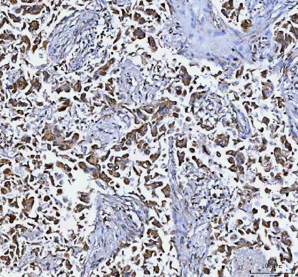 a01161 1 dapk1 primary antibodies ihc testing 4