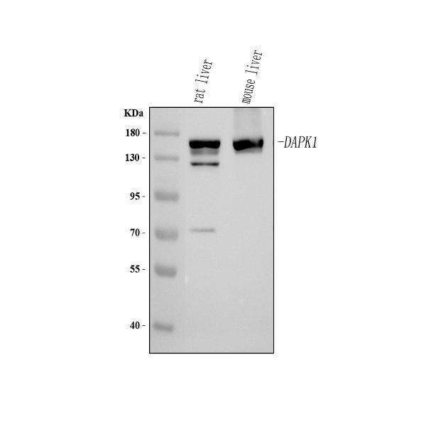  Western blot analysis of DAPK1 using anti-DAPK1 antibody (A01161-1)
