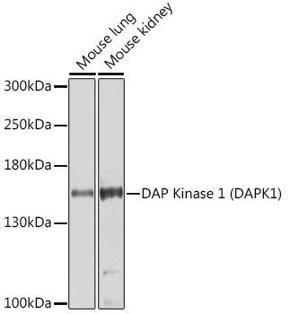 a01161 dapk1 primary antiboties wb testing 1