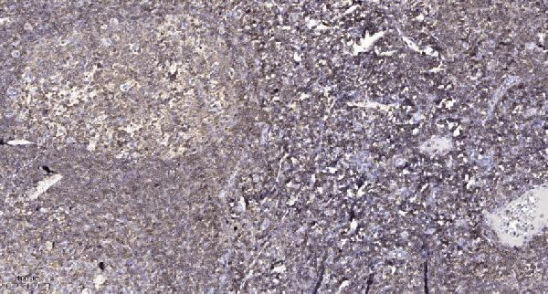 a01161s308 dapk1 primary antibodies ihc testing 1