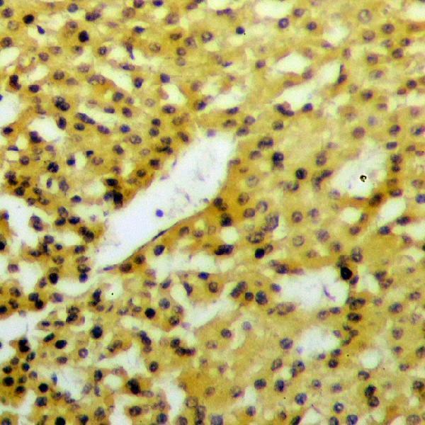 a01161s736 dapk1 primary antiboties ihc testing 2