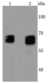 Western blot analysis of GBA on diffewrent cells lysates using anti-GBA antibody at 1/1,000 dilution