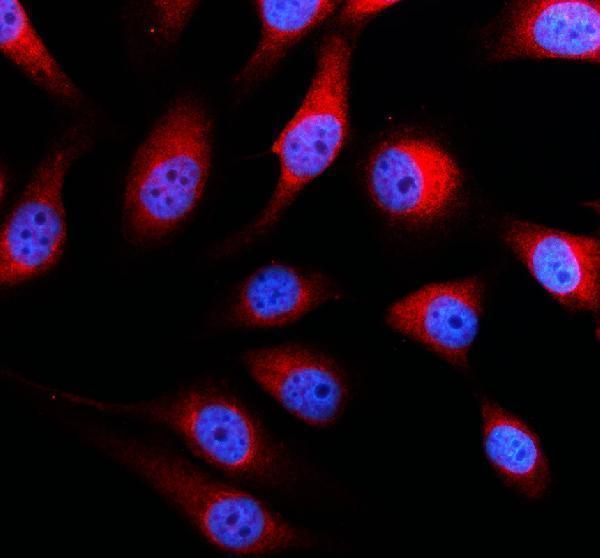 IF analysis of GBA/GBA1 using anti-GBA/GBA1 antibody (A01162-2)