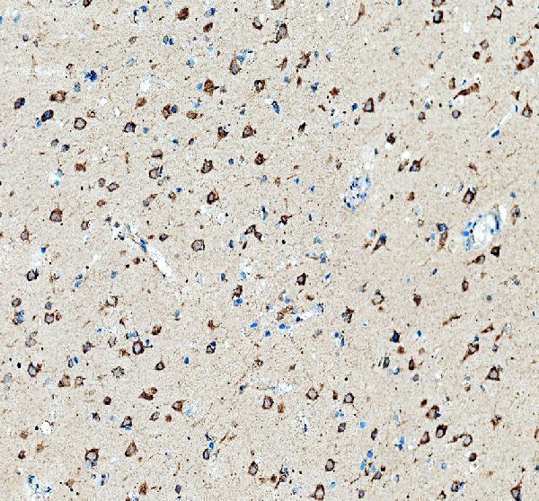 IHC analysis of GBA/GBA1 using anti-GBA/GBA1 antibody (A01162-2)