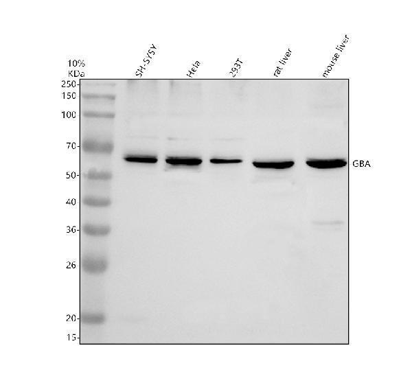 Anti-GBA/GBA1 Antibody Picoband&reg;