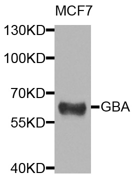Western blot analysis of extracts of MCF-7 cells, using Glucosylceramidase beta ) antibody  at 1:1000 dilution
