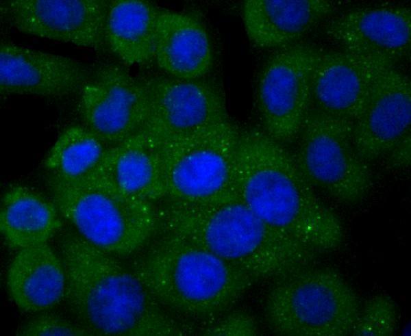 ICC staining PLGF in HepG2 cells (green)