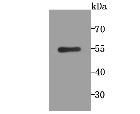 Western blot analysis of PLGF on SH-SY5Y cell lysate using anti-PLGF antibody at 1/1,000 dilution