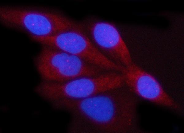 a01168 1 vdac1 primary antibodies if testing 10