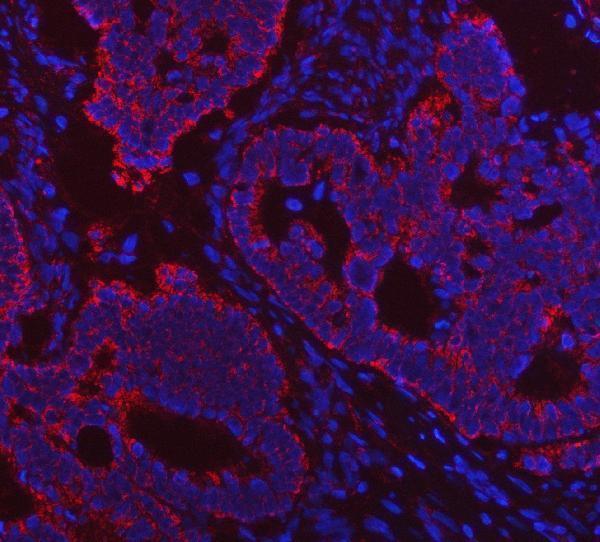 a01168 1 vdac1 primary antibodies if testing 11