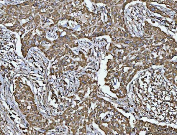  IHC analysis of Porin/VDAC1 using anti-Porin/VDAC1 antibody (A01168-1)