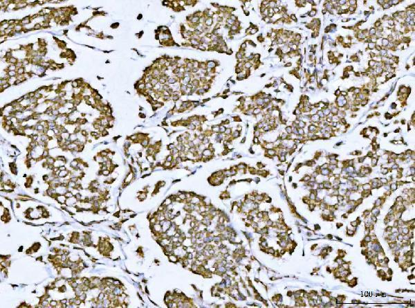  IHC analysis of Porin/VDAC1 using anti-Porin/VDAC1 antibody (A01168-1)
