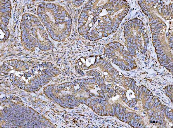 a01168 1 vdac1 primary antibodies ihc testing 4