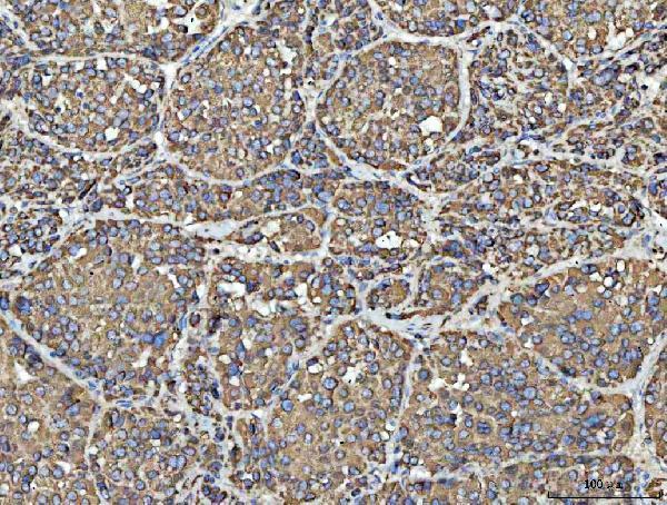 a01168 1 vdac1 primary antibodies ihc testing 5