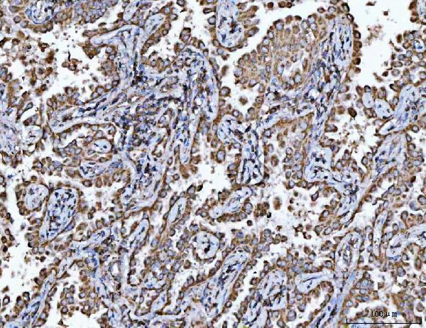 a01168 1 vdac1 primary antibodies ihc testing 6