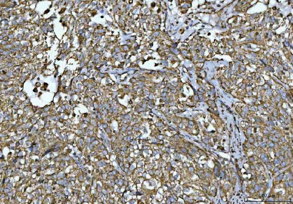 a01168 1 vdac1 primary antibodies ihc testing 7