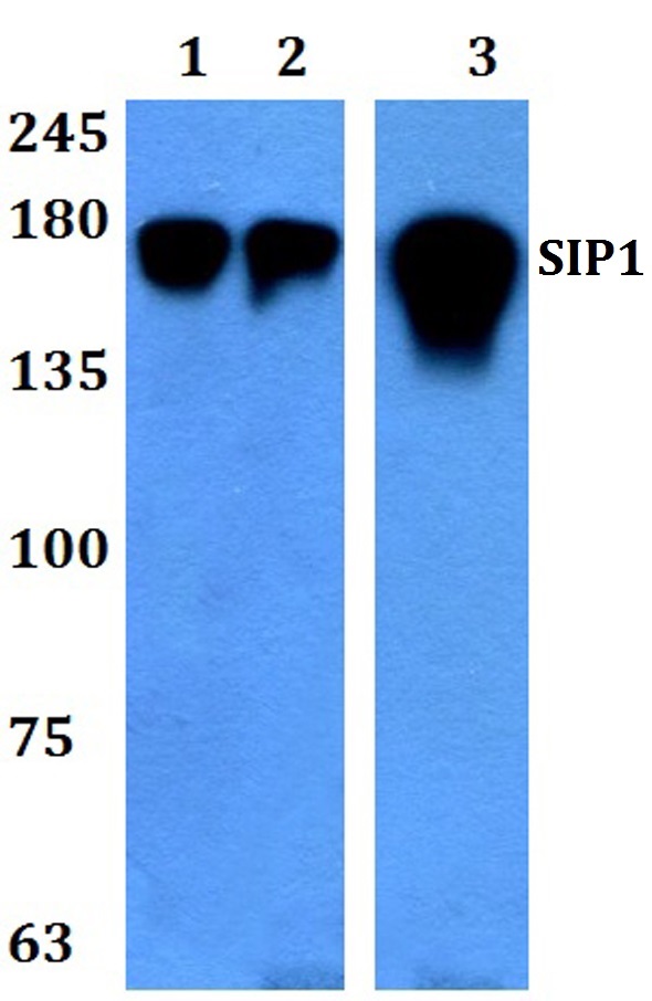 a01169 1 zeb2 primary antiboties wb testing 1