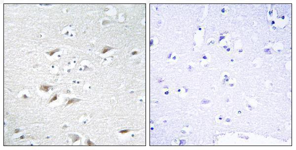 a01169 2 zeb2 primary antibodies ihc testing 1
