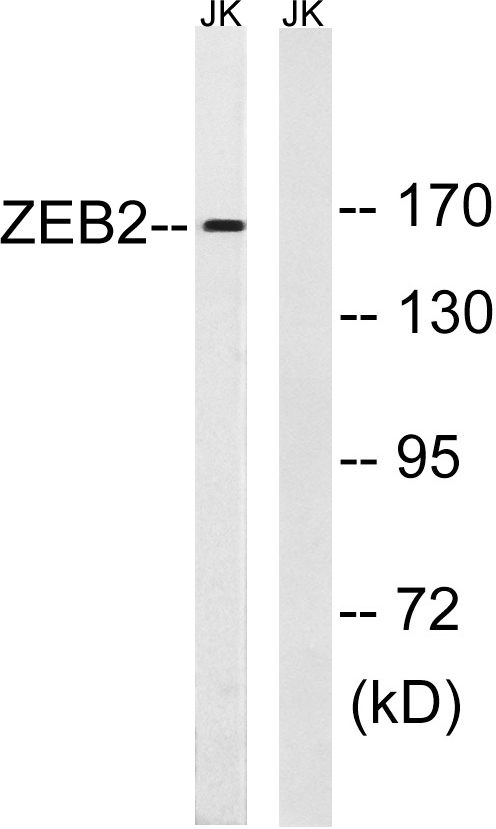 a01169 2 zeb2 primary antibodies wb testing 2