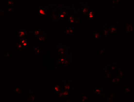 a01169 zeb2 primary antibodies if testing 4
