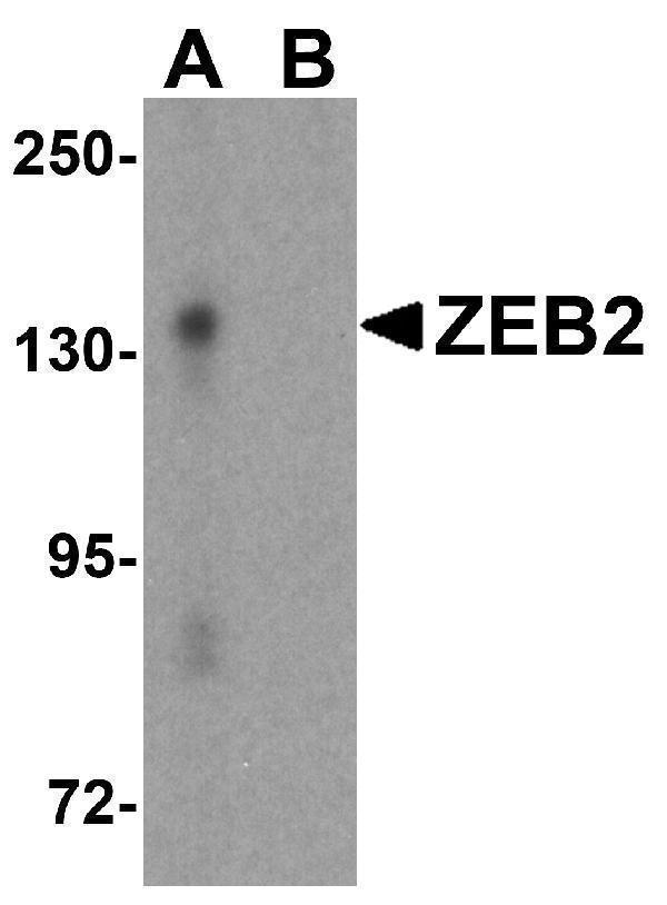 a01169 zeb2 primary antibodies wb testing 1
